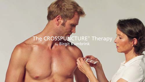 CROSSPUNCTURE